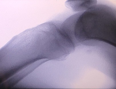 Significant joint perspective effect Significant joint perspective effect